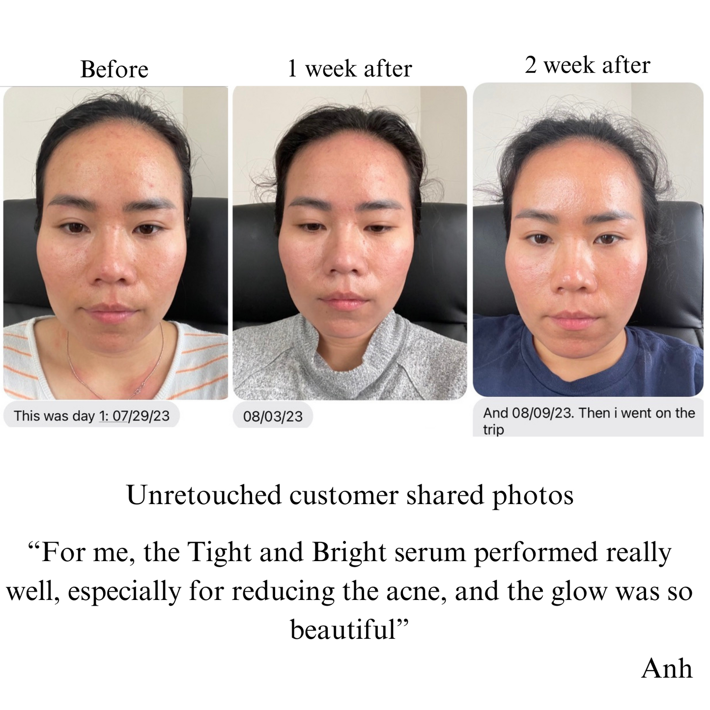 Full Face Care Bundle with Serums, Cream, Balm, and Mist NILCEUTICA