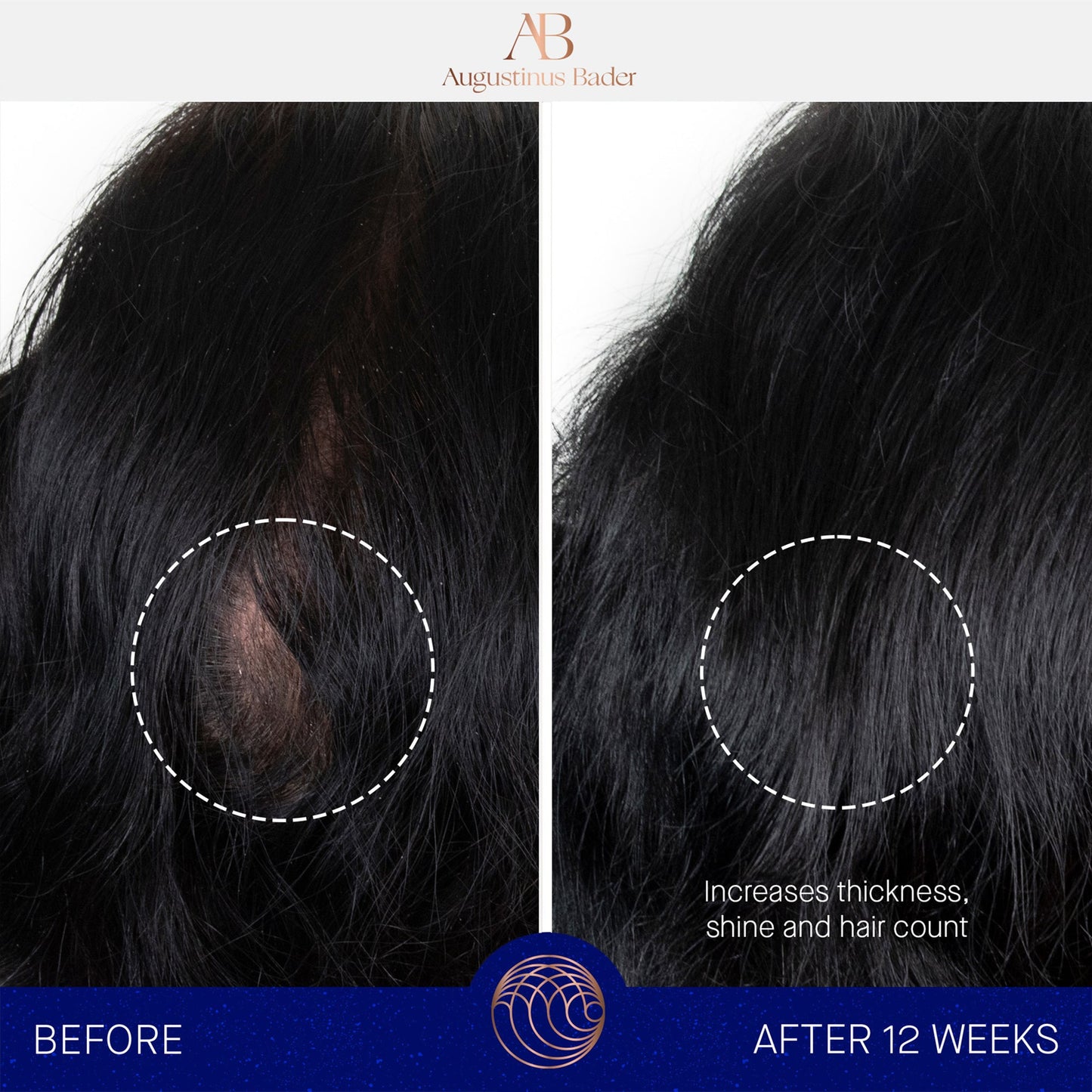 Scalp Treatment Innovative Serum for Hair Growth Wairua Beauty