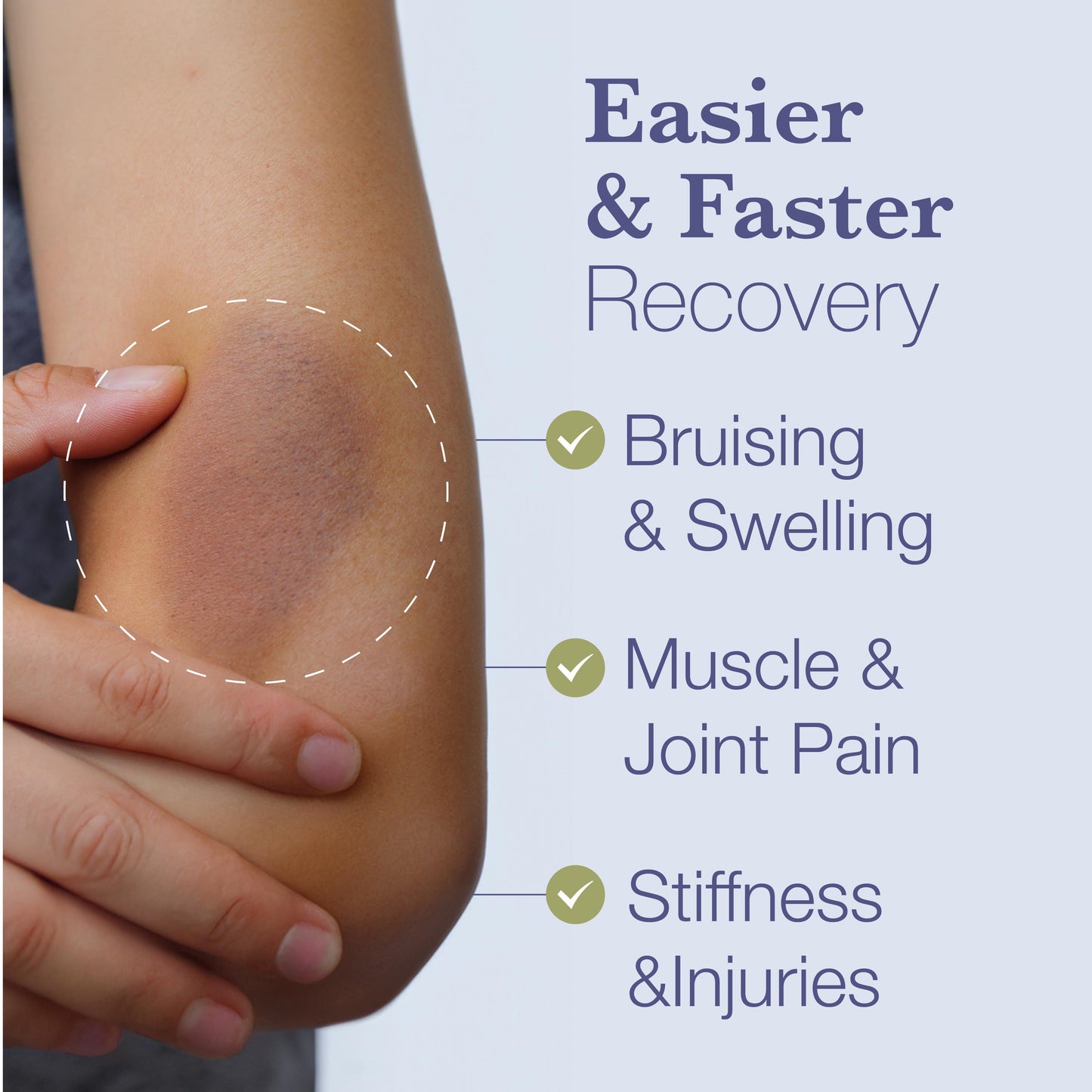 Topical Bruise Gel with Arnica and Caffeine BruiseMD