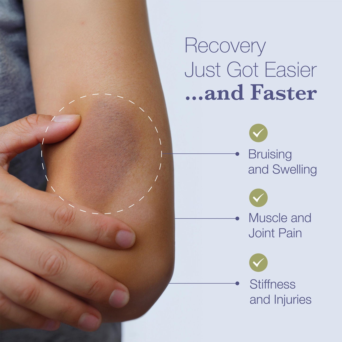Arnica Bromelain Supplement Capsules for Bruises and Swelling BruiseMD