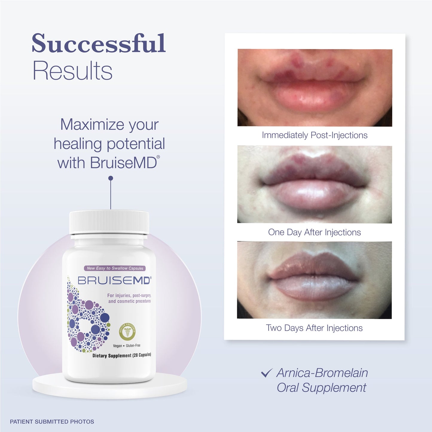 Arnica Bromelain Supplement Capsules for Bruises and Swelling BruiseMD