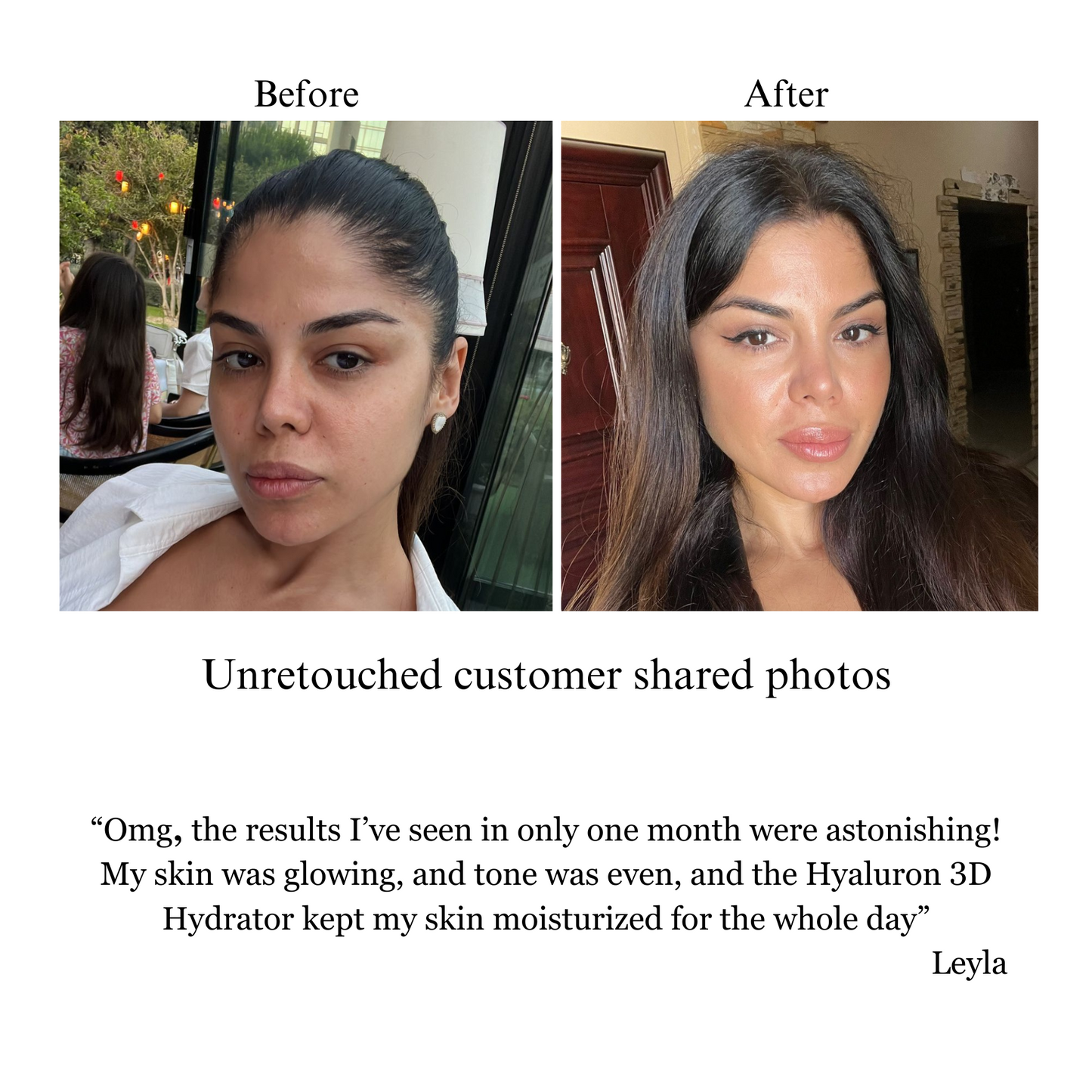 Full Face Care Bundle with Serums, Cream, Balm, and Mist NILCEUTICA