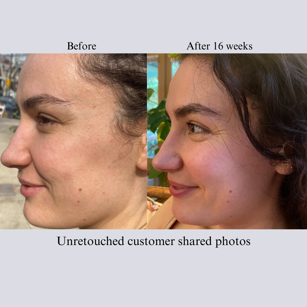 Full Face Care Bundle with Serums, Cream, Balm, and Mist NILCEUTICA