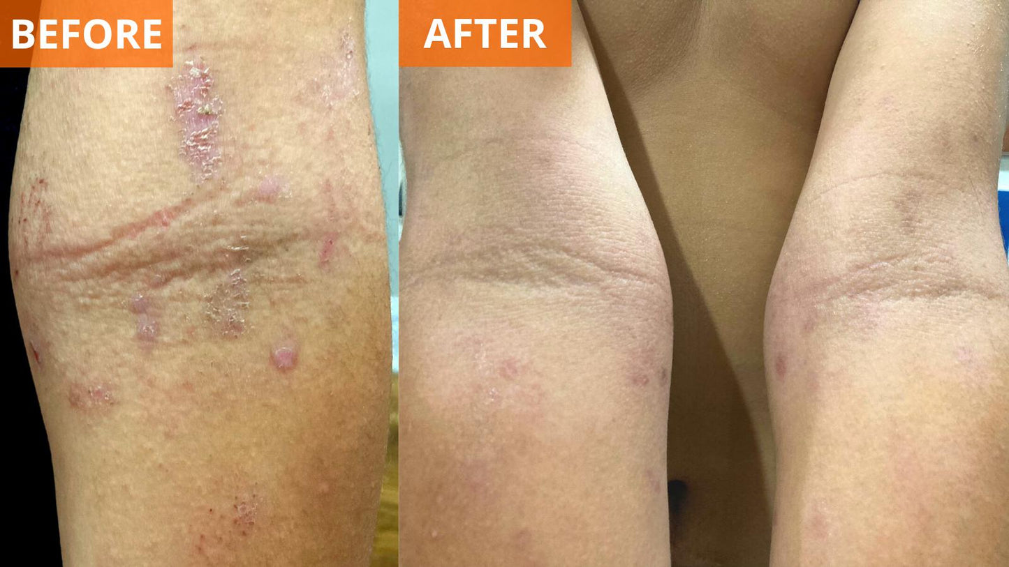 Moisturizing Skin Cream