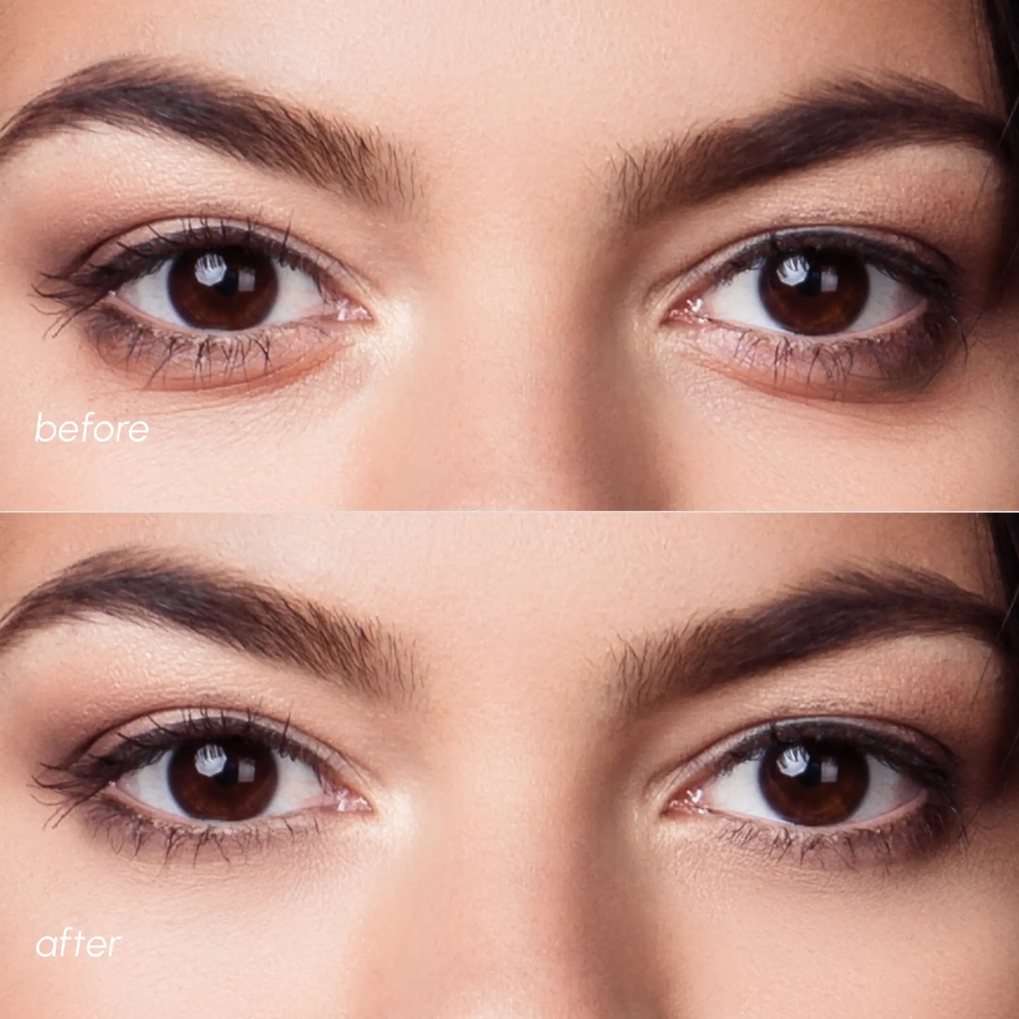 Violet Eye Patches Dark Circles Treatment Maree