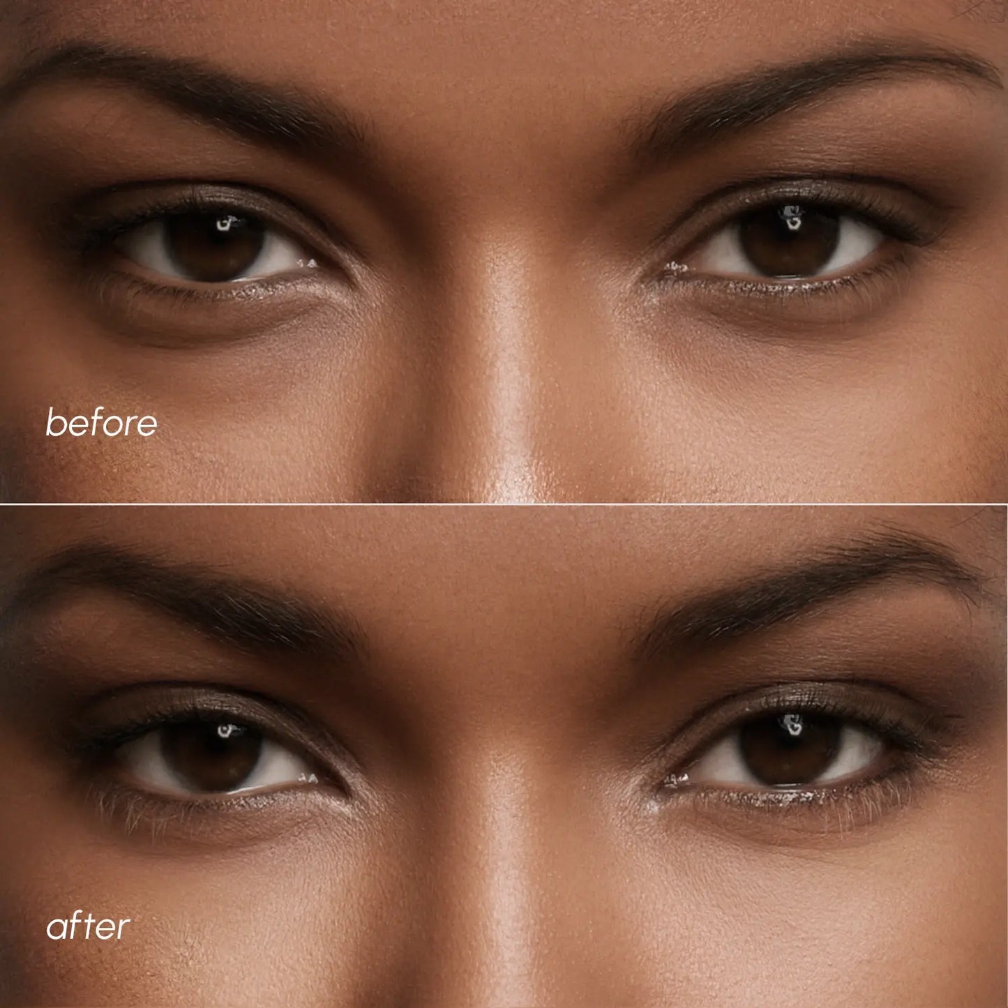 Violet Eye Patches Dark Circles Treatment Maree