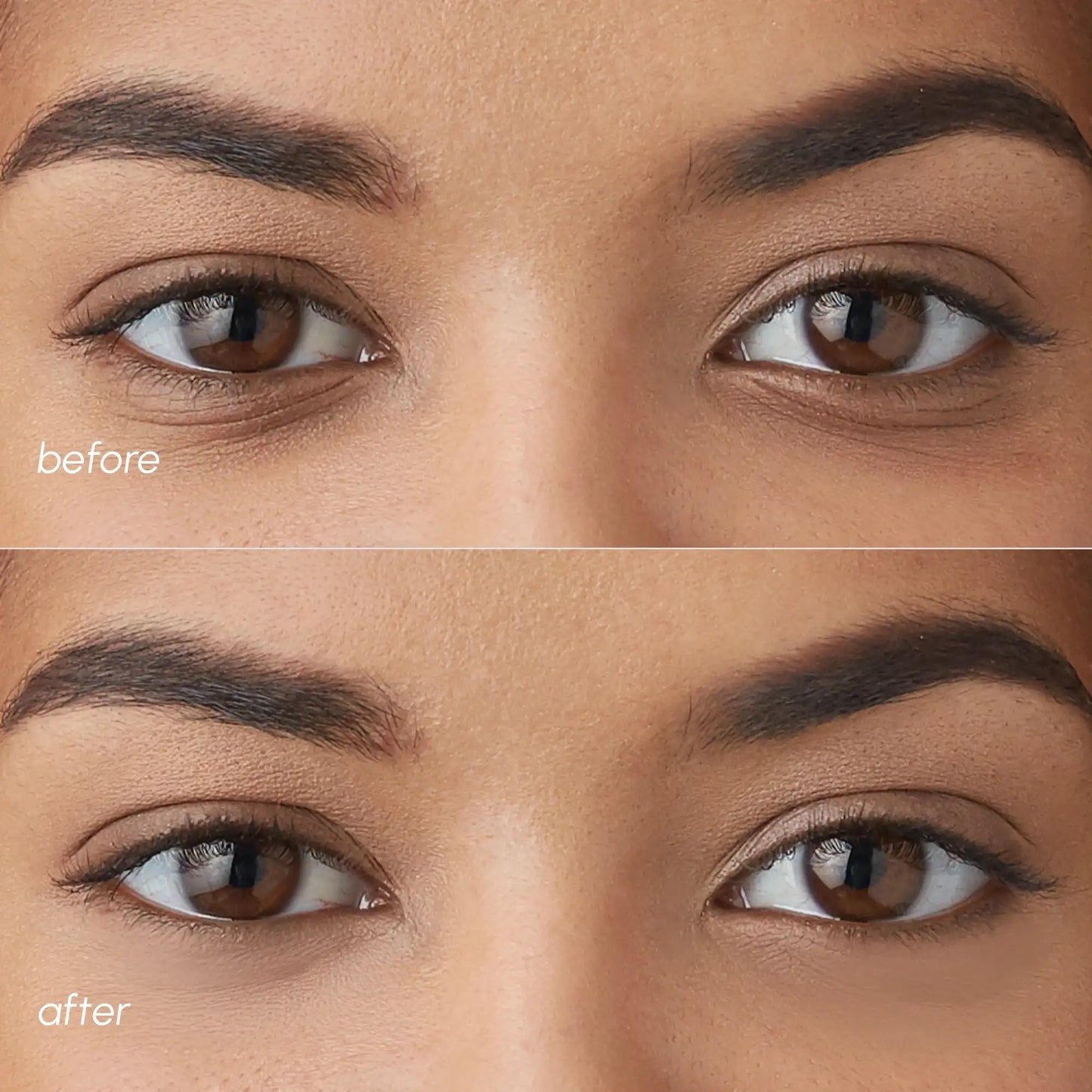 Violet Eye Patches Dark Circles Treatment Maree