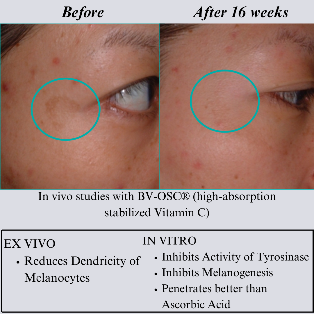 Full Face Care Bundle with Serums, Cream, Balm, and Mist NILCEUTICA