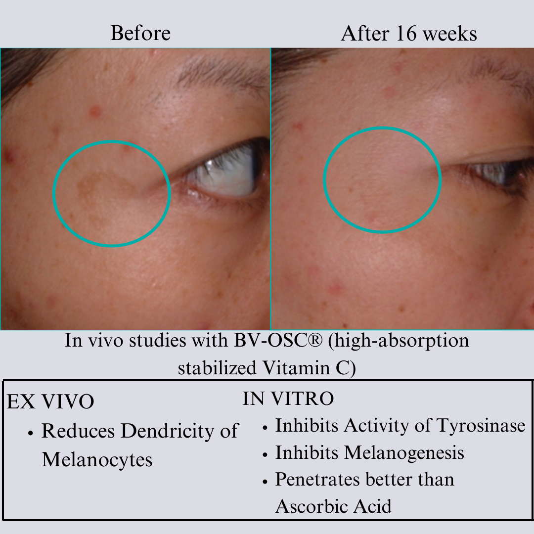 TIGHT AND BRIGHT Face Serum, an Advanced Formula with 12 Innovative Technologies, a Total of 55% High-Performance Cosmeceuticals