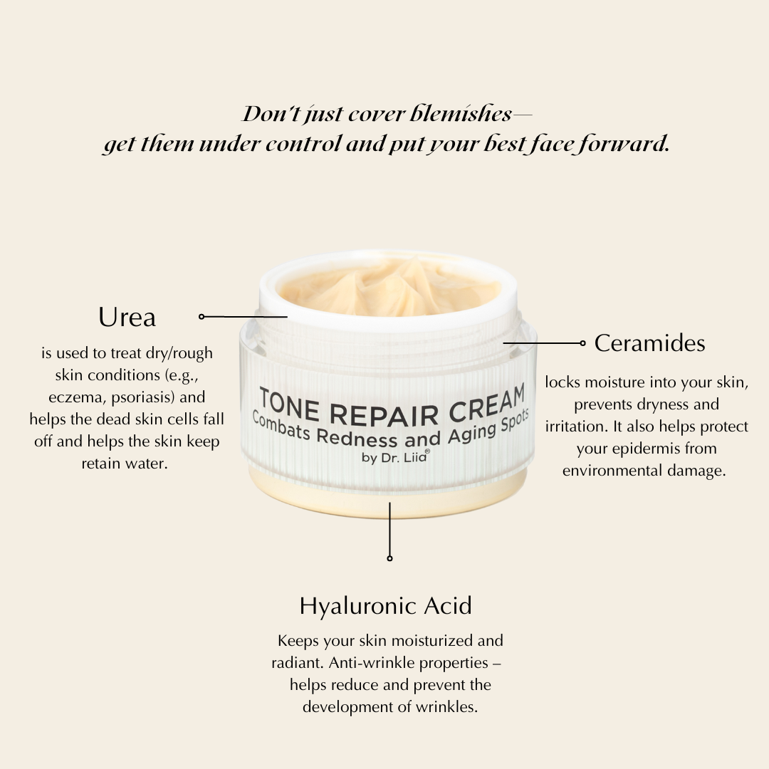 Brightening Face Cream for Redness & Hyperpigmentation Face Cream EpiLynx